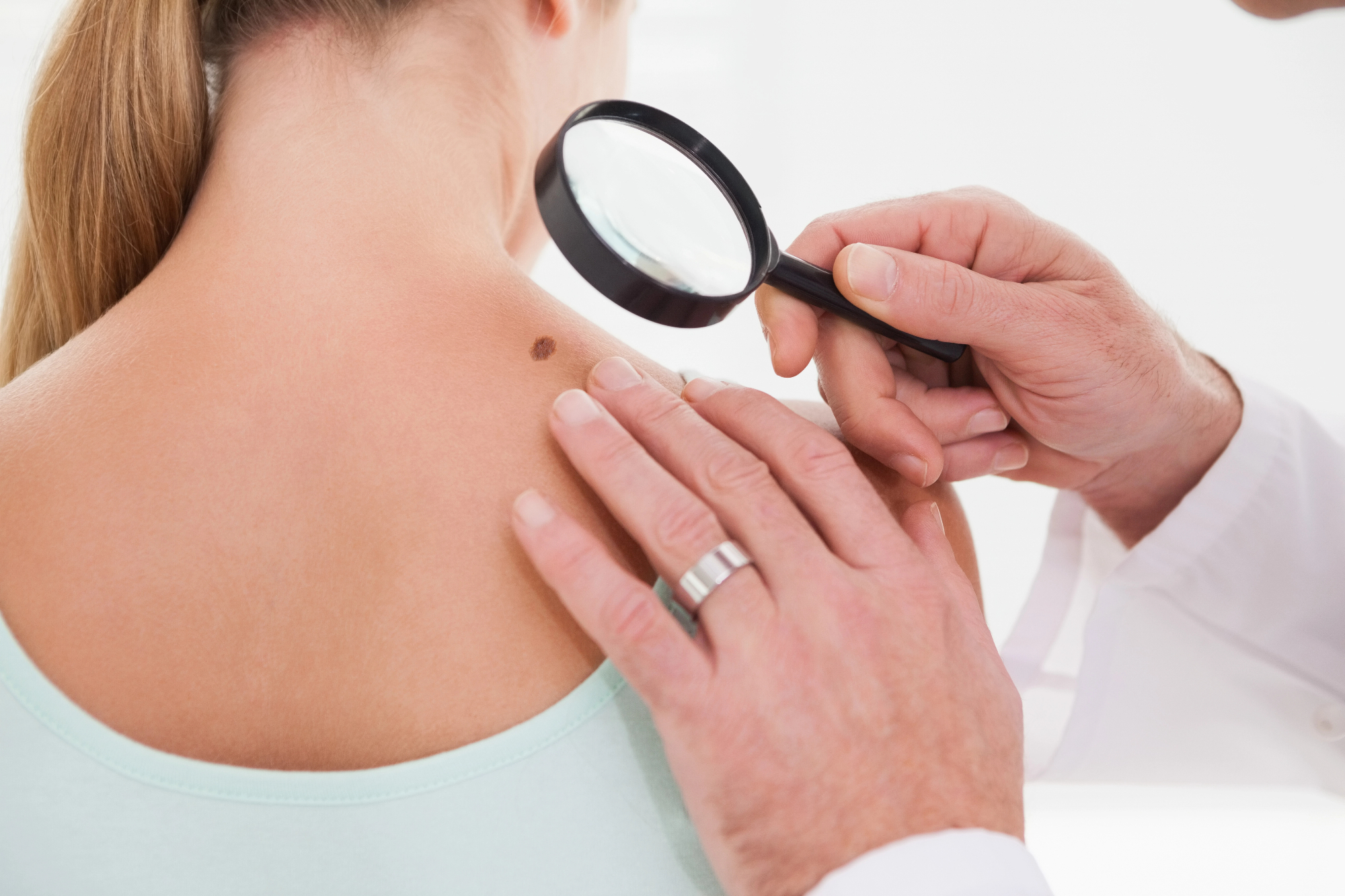 Dermatologija Ljubljana nudi številne ambulante